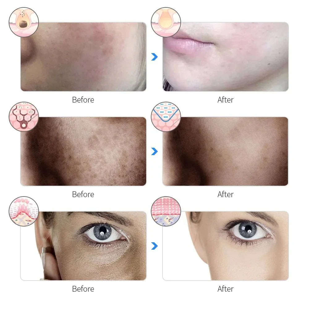GlowRevive LED Light Therapy Face Mask VIP